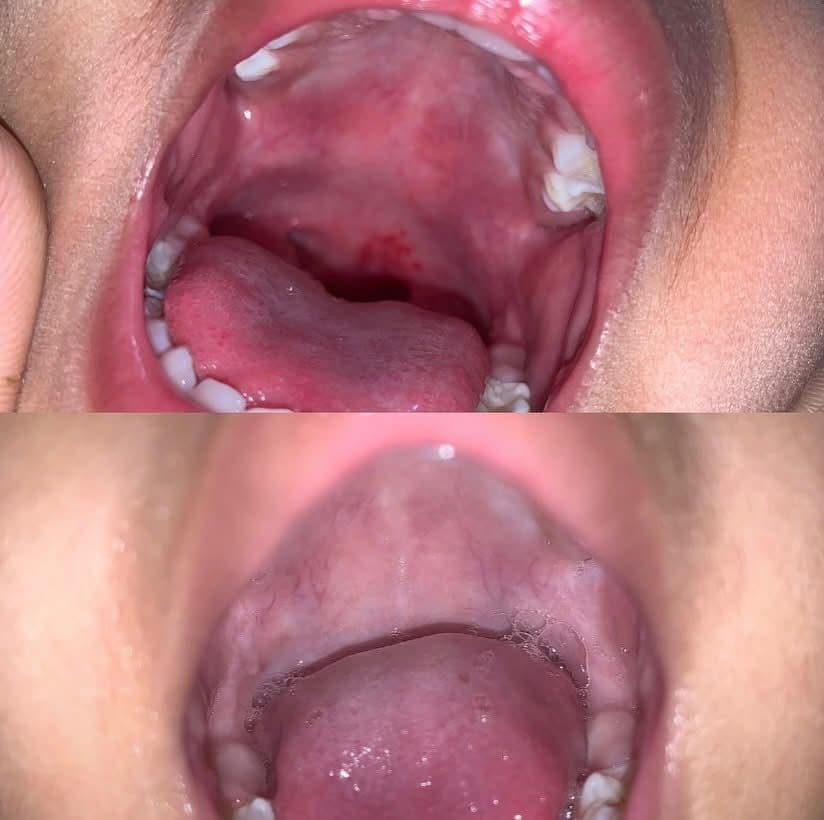 Patient image 15