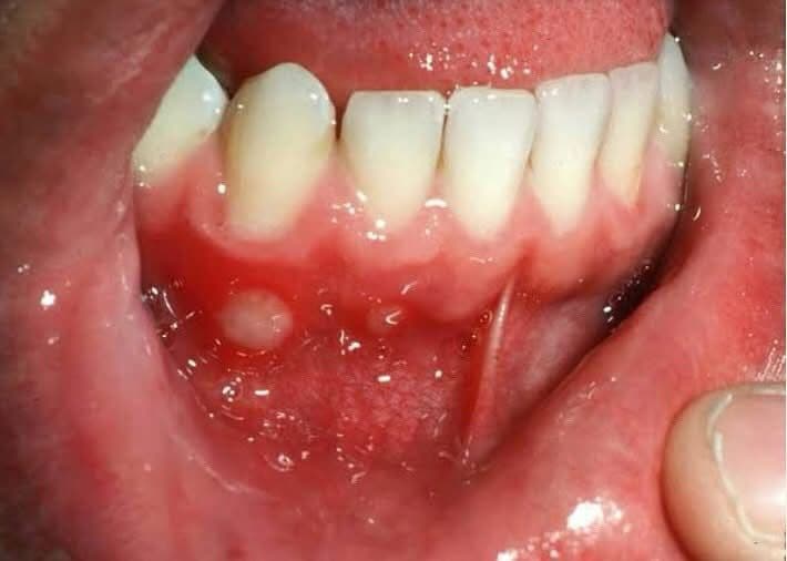 Patient image 4
