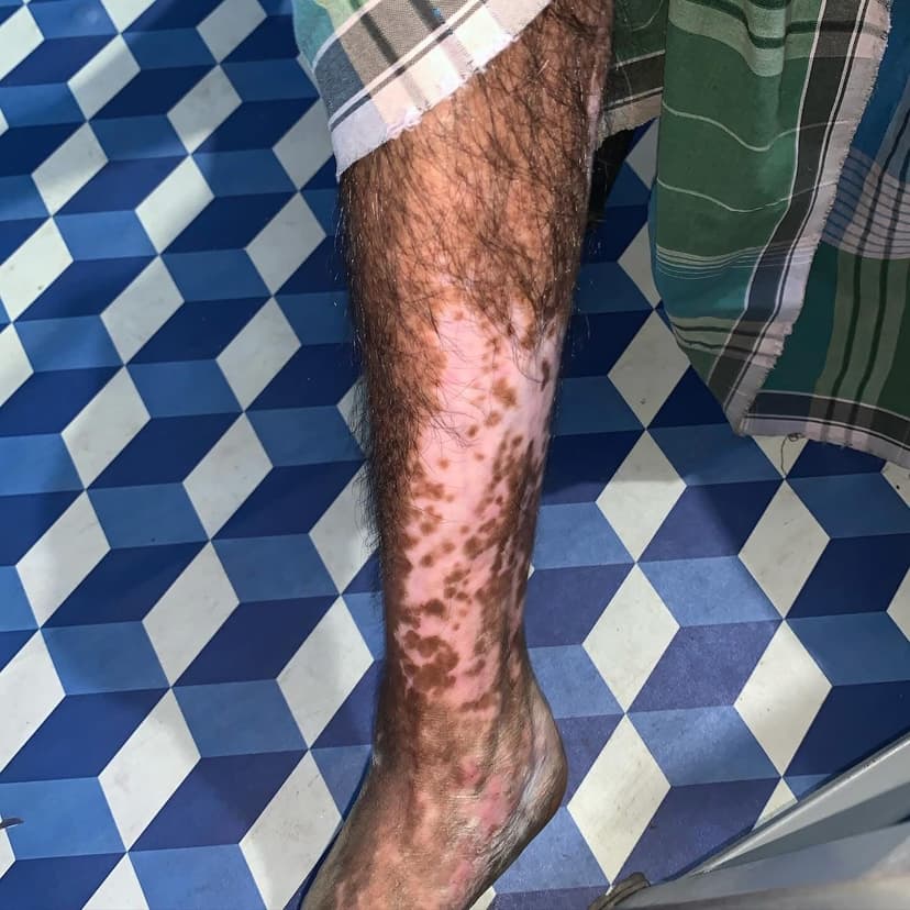 Patient image 7