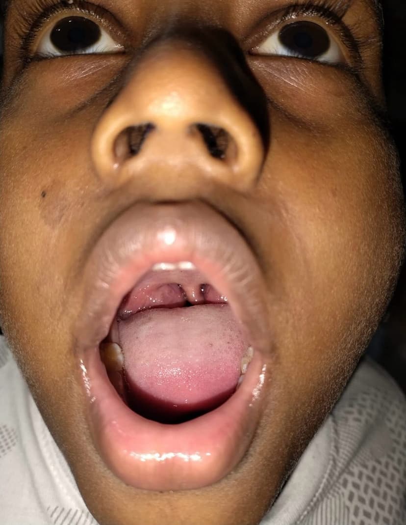 Patient image 9