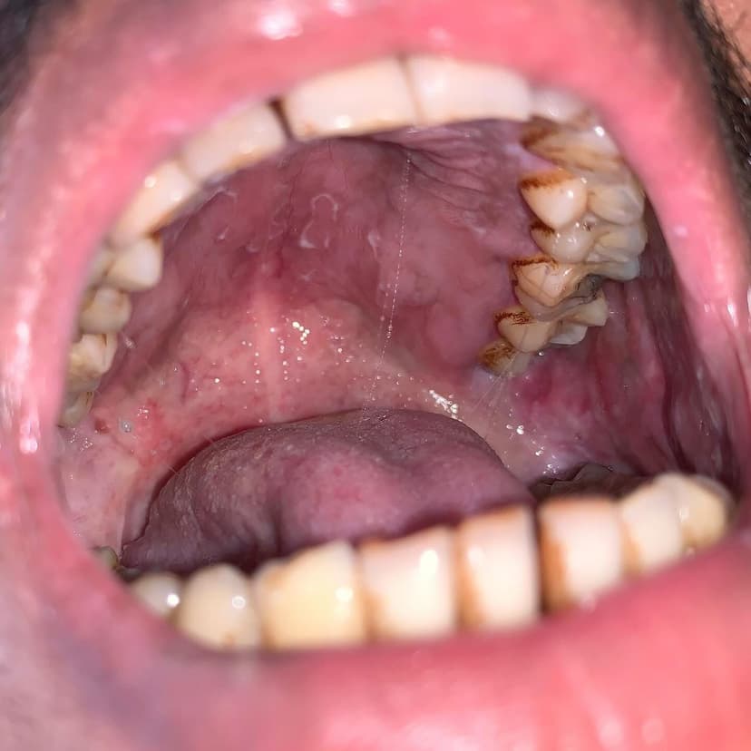 Patient image 3