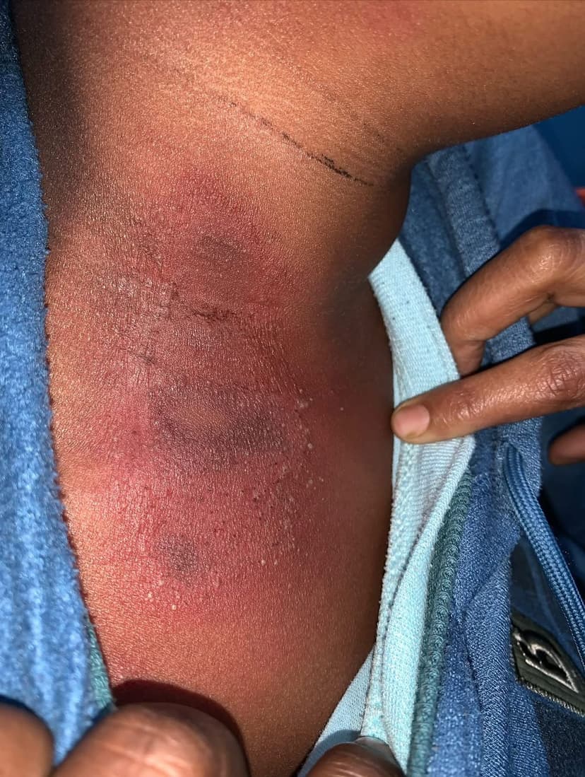Patient image 18