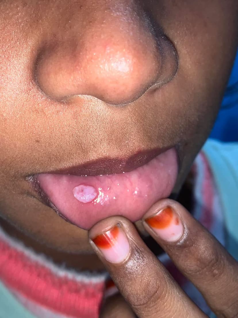 Patient image 32