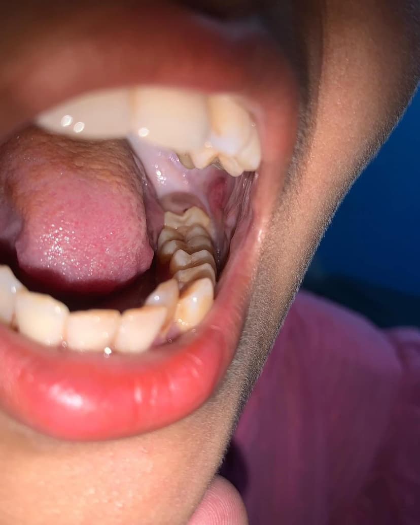 Patient image 23